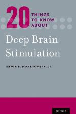 20 things to know about deep brain stimulation