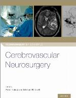 Cerebrovascular Neurosurgery