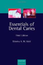 Essentials of Dental Caries: The Disease and Its Management