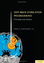 Deep Brain Stimulation Programming