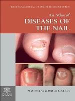 Atlas Of Diseases Of The Nail