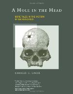 A Hole in the Head