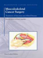 Musculoskeletal Cancer Surgery