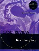 Brain Imaging