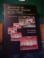 Essentials of Traumatic Injuries to the Teeth: A Step-by-Step Treatment Guide