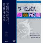 Systemic Lupus Erythematosus
