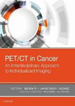 Pet/CT in Cancer