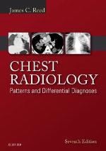 Chest Radiology