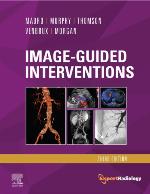 Image-Guided Interventions