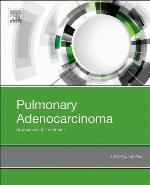 Pulmonary Adenocarcinoma