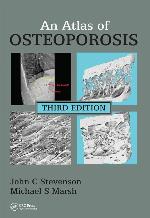 An Atlas of Osteoporosis