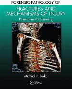 Forensic Pathology of Fractures and Mechanisms of Injury: Postmortem CT Scanning