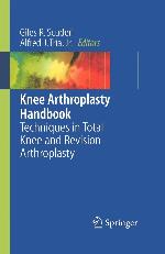Knee Arthroplasty Handbook