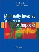 Minimally Invasive Surgery in Orthopedics