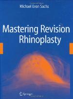 Mastering Revision Rhinoplasty