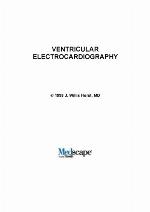 Ventricular electrocardiography