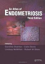Atlas of Endometriosis (Encyclopedia of Visual Medicine Series)