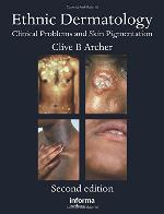 Ethnic Dermatology: Clinical Problems and Skin Pigmentation