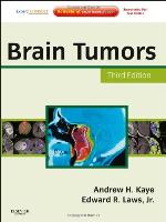 Brain Tumors
