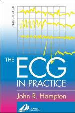 The Ecg In Practice
