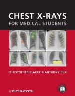 Chest X-Rays for Medical Students