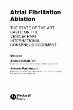 Atrial Fibrillation Ablation