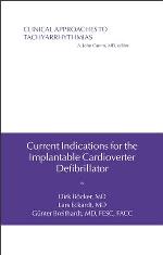 Current indications for the implantable cardioverter defibrillator