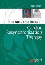 The nuts and bolts of cardiac resynchronization therapy
