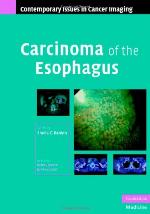 Carcinoma of the Esophagus