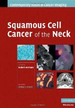 Squamous Cell Cancer of the Neck