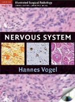 Nervous System