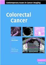 Colorectal Cancer