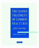 The Closed Treatment of Common Fractures
