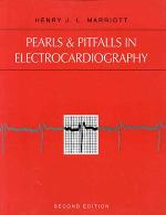 Pearls &amp; Pitfalls In Electrocardiography