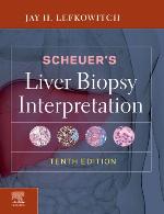 Scheuer's Liver Biopsy Interpretation