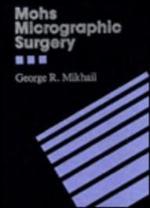 Mohs Micrographic Surgery