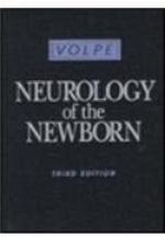 Neurology of the Newborn