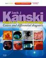 Signs in Ophthalmology