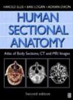 Human Sectional Anatomy: Atlas Of Body Sections, CT and MRI Images