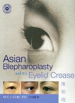 Asian Blepharoplasty and the Eyelid Crease [With Dvdrom]