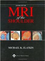MRI of the Shoulder