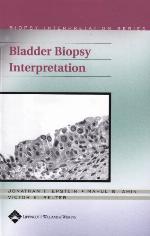 Bladder Biopsy Interpretation