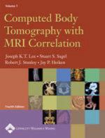 Computed Body Tomography with MRI Correlation