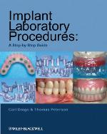 Implant Laboratory Procedures