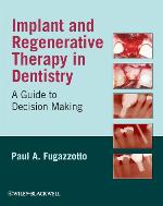Implant and Regenerative Therapy in Dentistry: A Guide to Decision Making