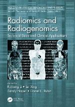 Radiomics and Radiogenomics
