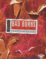 Bad Burns