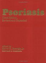 Psoriasis
