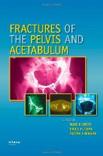 Fractures of the Pelvis and Acetabulum