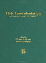 Hair Transplantation